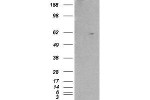 Western Blotting (WB) image for Retinoid X Receptor, beta (RXRB) peptide (ABIN369746)