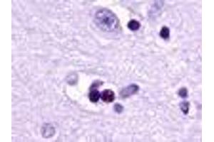 Image no. 2 for anti-Lysophosphatidic Acid Receptor 1 (LPAR1) (Cytoplasmic Domain) antibody (ABIN1048528)