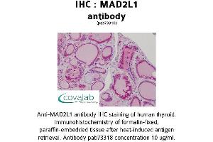 Image no. 2 for anti-MAD2 Mitotic Arrest Deficient-Like 1 (Yeast) (MAD2L1) (AA 1-174) antibody (ABIN1736663)