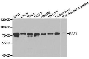 Image no. 4 for anti-V-Raf-1 Murine Leukemia Viral Oncogene Homolog 1 (RAF1) (C-Term) antibody (ABIN3020713)
