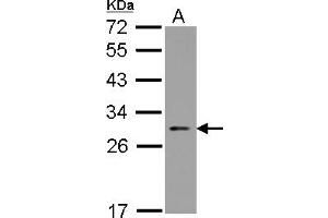 Image no. 2 for anti-Nucleolar Protein 3 (Apoptosis Repressor with CARD Domain) (NOL3) (AA 1-197) antibody (ABIN1501899)