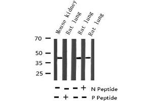 Image no. 11 for anti-Jun Proto-Oncogene (JUN) (pThr93) antibody (ABIN6255754)