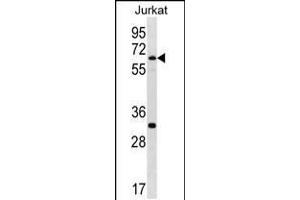 Image no. 1 for anti-SWI/SNF Related, Matrix Associated, Actin Dependent Regulator of Chromatin, Subfamily D, Member 1 (SMARCD1) (AA 431-459), (C-Term) antibody (ABIN5537541)