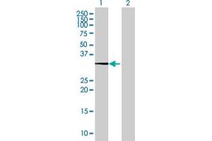 Image no. 1 for anti-Heat Shock Transcription Factor 2 Binding Protein (HSF2BP) (AA 1-334) antibody (ABIN524485)