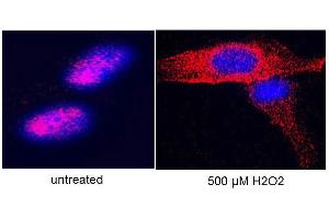 Image no. 3 for anti-Telomerase Reverse Transcriptase (TERT) (C-Term) antibody (ABIN6655270)