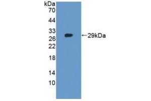 Image no. 2 for anti-Tankyrase, TRF1-Interacting Ankyrin-Related ADP-Ribose Polymerase 2 (TNKS2) (AA 959-1166) antibody (ABIN1871737)