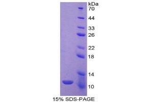 Image no. 1 for Indoleamine 2,3-Dioxygenase (IDO) (AA 276-360) protein (His tag) (ABIN1170681)