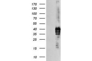 Image no. 2 for anti-serine Dehydratase (SDS) antibody (ABIN2731548)