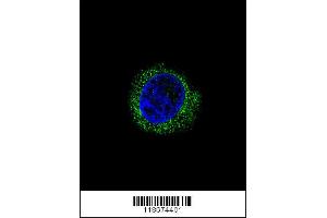 Image no. 1 for anti-alpha-2-HS-Glycoprotein (AHSG) (AA 247-276), (C-Term) antibody (ABIN654065)