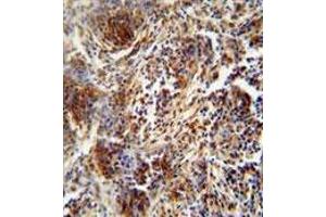 Image no. 3 for anti-Zinc Finger Protein 30 (ZFP30) (AA 1-30), (N-Term) antibody (ABIN955700)