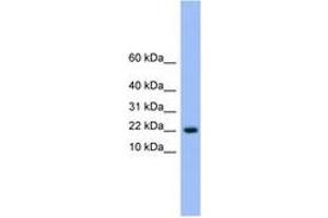 Image no. 1 for anti-NTF2-Related Export Protein 1 (NXT1) (AA 41-90) antibody (ABIN6745580)