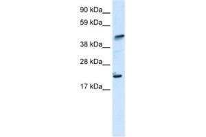 Image no. 1 for anti-IKAROS Family Zinc Finger 5 (Pegasus) (IKZF5) antibody (ABIN2460681)