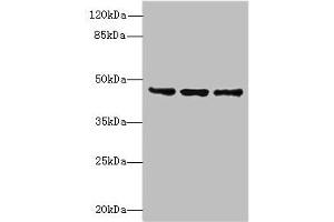 Western blot All lanes: FAM53B antibody at 2 μg/mL Lane 1: MCF-7 whole cell lysate Lane 2: A549 whole cell lysate Lane 3: HCT116 whole cell lysate Secondary Goat polyclonal to rabbit IgG at 1/10000 dilution Predicted band size: 46, 34 kDa Observed band size: 46 kDa