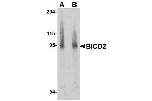 Image no. 1 for anti-Bicaudal D Homolog 2 (BICD2) (Internal Region) antibody (ABIN342680)