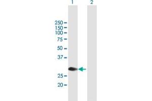 Image no. 1 for anti-Protein L-Myc (MYCL) (AA 1-206) antibody (ABIN518130)