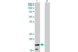 Image no. 1 for anti-Calmodulin-Like 5 (CALML5) (AA 1-146) antibody (ABIN526938)