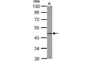 Image no. 1 for anti-Lipase A, Lysosomal Acid, Cholesterol Esterase (LIPA) (Center) antibody (ABIN2854960)