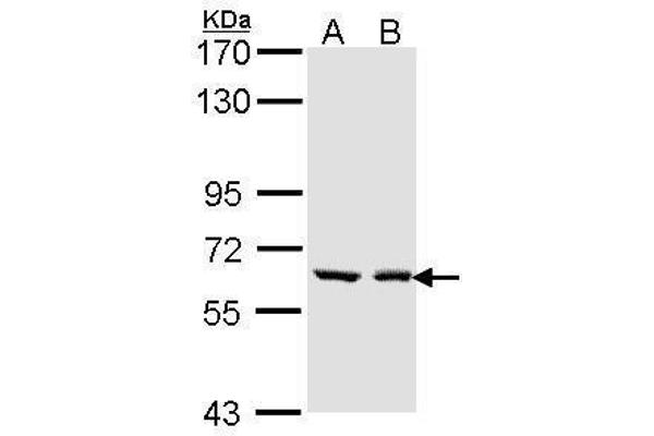 anti-UDP Glucuronosyltransferase 1 Family, Polypeptide A6 (UGT1A6) (Center) antibody