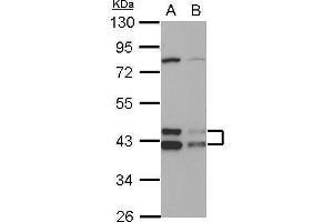 WB Image Sample (30 ug of whole cell lysate) A: HepG2 B: HCT116 10% SDS PAGE antibody diluted at 1:1000