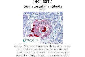 Image no. 2 for anti-Somatostatin (SST) antibody (ABIN1739665)