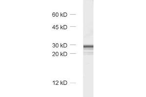 Image no. 2 for anti-Calbindin 2 (CALB2) antibody (ABIN1742426)