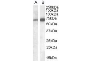 Image no. 1 for anti-Eukaryotic Elongation Factor, Selenocysteine-tRNA-Specific (EEFSEC) (C-Term) antibody (ABIN2790209)