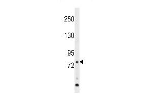 GP Antibody (Center) (ABIN1538412 and ABIN2848584) western blot analysis in WiDr cell line lysates (35 μg/lane).