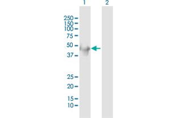 Keratin 34 antibody  (AA 1-436)