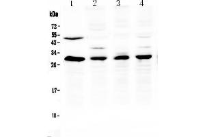 Image no. 1 for anti-B-Cell CLL/lymphoma 2 (BCL2) (AA 102-140), (Middle Region) antibody (ABIN5518894)