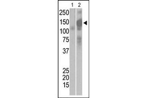 The anti-SARS-Sm Pab (ABIN1882128 and ABIN2840581) is used in Western blot to detect recombinant Spike proteins, aa17-537 (Lane 1) and aa17-756 (Lane 2).