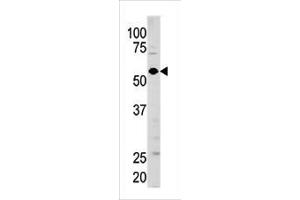 Image no. 1 for anti-Guanylate Cyclase 1 Soluble Subunit Alpha (GUCY1A1) (AA 269-300), (N-Term) antibody (ABIN391201)