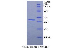 Image no. 1 for DEAD (Asp-Glu-Ala-Asp) Box Polypeptide 58 (DDX58) (AA 1-211) protein (His tag) (ABIN1879187)