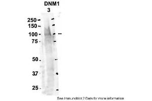 Image no. 2 for anti-Dynamin 1 (DNM1) (Middle Region) antibody (ABIN2784624)
