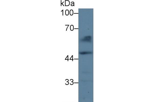 Coagulation Factor X anticorps  (AA 21-481)