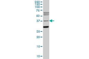 Image no. 2 for anti-ISL LIM Homeobox 1 (ISL1) (AA 63-159) antibody (ABIN561536)