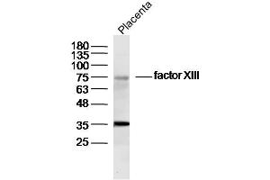 Image no. 3 for anti-Coagulation Factor XIII (F13) (AA 331-732) antibody (ABIN731738)
