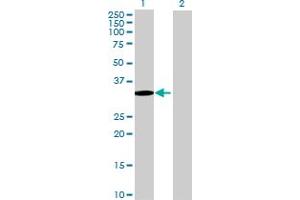 Image no. 1 for anti-SET Binding Protein 1 (SETBP1) (AA 1-242) antibody (ABIN525557)
