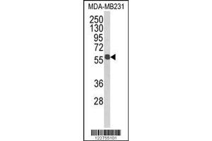 Image no. 1 for anti-Aldehyde Dehydrogenase 3 Family, Member B1 (ALDH3B1) (AA 334-360) antibody (ABIN652651)