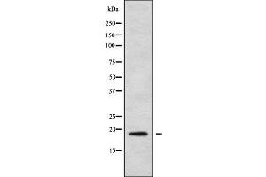 Western blot analysis of MRPL30 using HeLa whole cell lysates