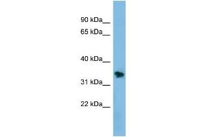 Image no. 1 for anti-Non-SMC Element 1 Homolog (NSMCE1) (Middle Region) antibody (ABIN2781252)