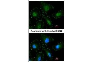 Image no. 2 for anti-Calpain 5 (CAPN5) (Center) antibody (ABIN2855597)