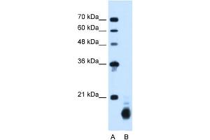 Image no. 1 for anti-Cyclophilin B (PPIB) (C-Term) antibody (ABIN2781833)