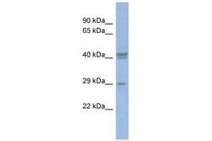 Image no. 1 for anti-CCAAT/enhancer Binding Protein (C/EBP), delta (CEBPD) (C-Term) antibody (ABIN6742779)
