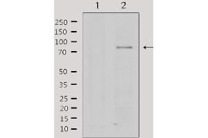 Image no. 4 for anti-Protein Arginine Methyltransferase 5 (PRMT5) antibody (ABIN6266359)