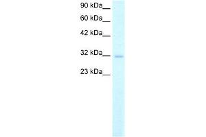 Image no. 2 for anti-Msh Homeobox 1 (MSX1) (Middle Region) antibody (ABIN2777275)