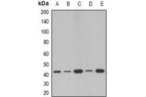 Image no. 2 for anti-serpin Peptidase Inhibitor, Clade B (Ovalbumin), Member 1 (SERPINB1) (full length) antibody (ABIN6005302)