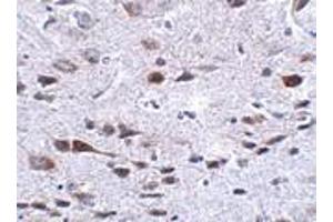 Image no. 1 for anti-Protein Aurora Borealis (BORA) (C-Term) antibody (ABIN499489)