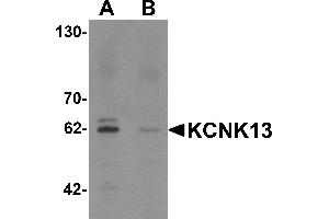 Image no. 1 for anti-Potassium Channel Subfamily K Member 13 (KCNK13) (Middle Region) antibody (ABIN1030973)