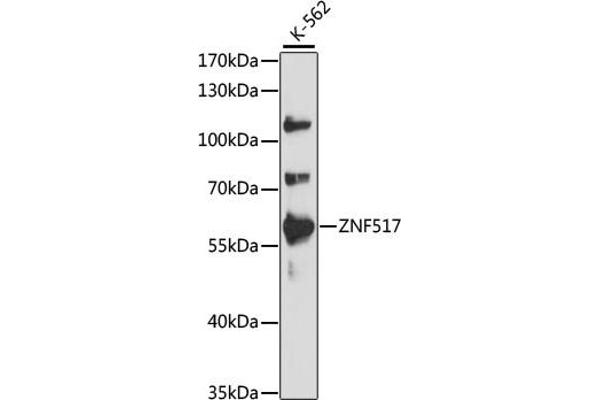 ZNF517 抗体  (AA 70-180)
