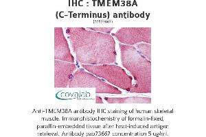 Image no. 1 for anti-Transmembrane Protein 38A (TMEM38A) (C-Term) antibody (ABIN1740157)